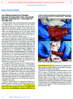 Zinc Deficiency Dermatitis in Cholestatic Extremely Premature Infants After a Nationwide Shortage of Injectable Zinc  Washington DC December 2012