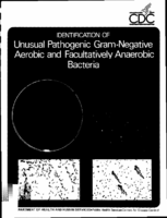 Identification of unusual pathogenic gramnegative aerobic and facultatively anaerobic bacteria