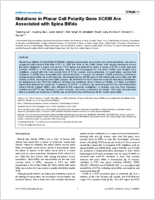 Mutations in Planar Cell Polarity Gene SCRIB Are Associated with Spina Bifida