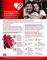 Conozca el riesgo y los sntomas de la enfermedad de las vlvulas cardacas