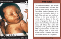 Rubella