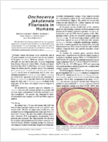 Onchocerca jakutensis Filariasis in Humans