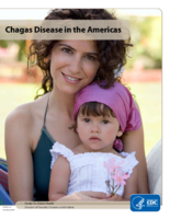 Chagas disease in the Americas