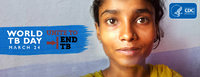 World TB Day  March 24