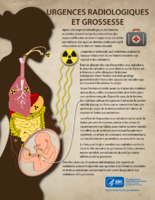 Urgence radiologiques et grossesse
