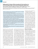 Radiographic Evidence of Nonoccupational Asbestos Exposure from Processing Libby Vermiculite in Minneapolis Minnesota