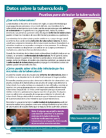 Pruebas para detectar la tuberculosis