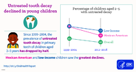 Untreated tooth decay declined in young children