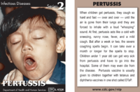 Pertussis