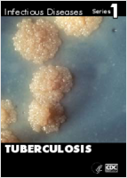 Tuberculosis
