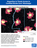 MS Drive Time to Advanced Stroke Care