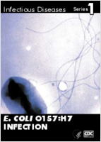 E coli O157H7 Infection