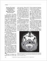 Acute Cervical Lymphadenitis Caused by Mycobacterium florentinum
