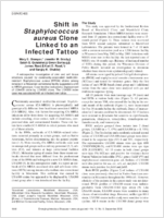 Shift in Staphylococcus aureus Clone Linked to an Infected Tattoo
