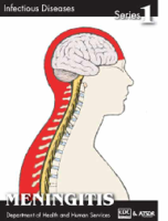 Meningitis