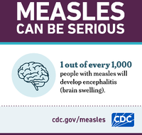 Measles Can be Serious Brain Swelling