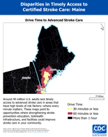 ME Drive Time to Advanced Stroke Care