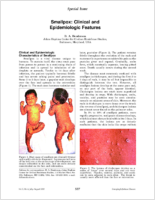 Smallpox clinical and epidemiologic features