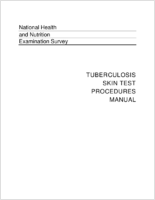 National Health and Nutrition Examination Survey tuberculosis skin test procedures manual