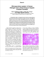 Rhinosporidium seeberi a human pathogen from a novel group of aquatic protistan parasites
