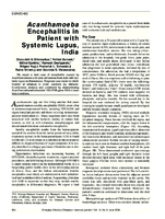 Acanthamoeba Encephalitis in Patient with Systemic Lupus India