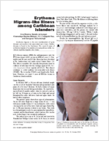Erythema Migranslike Illness among Caribbean Islanders