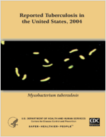 Reported Tuberculosis in the United States 2004