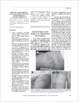 Comet Sign and Other in Pyemotes Dermatitis