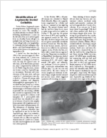 Identification of Legionella feeleii Cellulitis