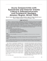 Acute Conjunctivitis with Episcleritis and Anterior Uveitis Linked to Adiaspiromycosis and Freshwater Sponges Amazon Region Brazil 2005