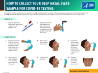 How to collect your deep nasal swab sample for COVID19 testing