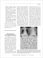 Disseminated Coccidioidomycosis