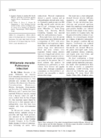 Williamsia muralis Pulmonary Infection