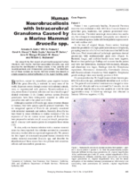 Human Neurobrucellosis with Intracerebral Granuloma Caused by a Marine Mammal Brucella spp