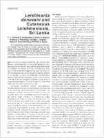 Leishmania donovani and Cutaneous Leishmaniasis Sri Lanka