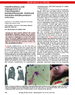 Manifestations and Management of TrimethoprimSulfamethoxazoleResistant Nocardia otitidiscaviarum Infection