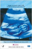 Aunque una madre tenga el VIH el bebe no tiene por que contraerlo