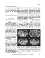 Brucellosis Reactivation after 28 Years
