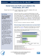Dental Caries and Tooth Loss in Adults in the United States 20112012