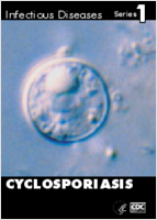 Cyclosporiasis