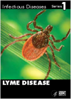 Lyme disease