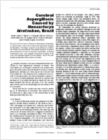 Cerebral Aspergillosis Caused by Neosartorya hiratsukae Brazil