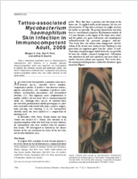 Tattooassociated Mycobacterium haemophilum Skin Infection in Immunocompetent Adult 2009