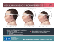 Measuring Head Circumference 3162016