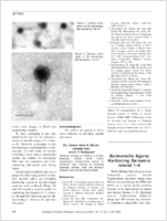 Salmonella Agona Harboring Genomic Island 1A