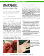 Hand Foot and Mouth Disease as Differential Diagnosis of Monkeypox Germany August 2022