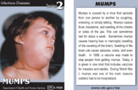 Mumps