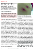 Rickettsiosis Caused by Rickettsia parkeri Mexico