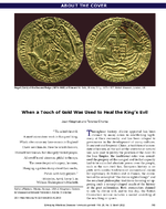 When a Touch of Gold Was Used to Heal the Kings Evil