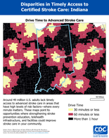 IN Drive Time to Advanced Stroke Care